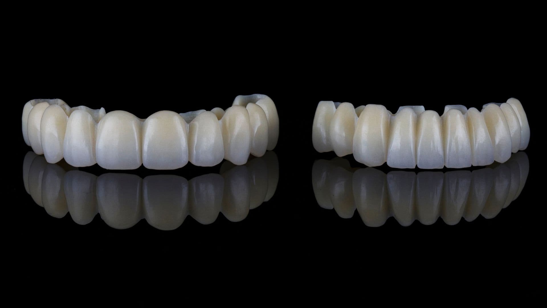 Affordable Full Mouth Rehabilitation near Alambadi, Porbandar for a Beautiful Smile