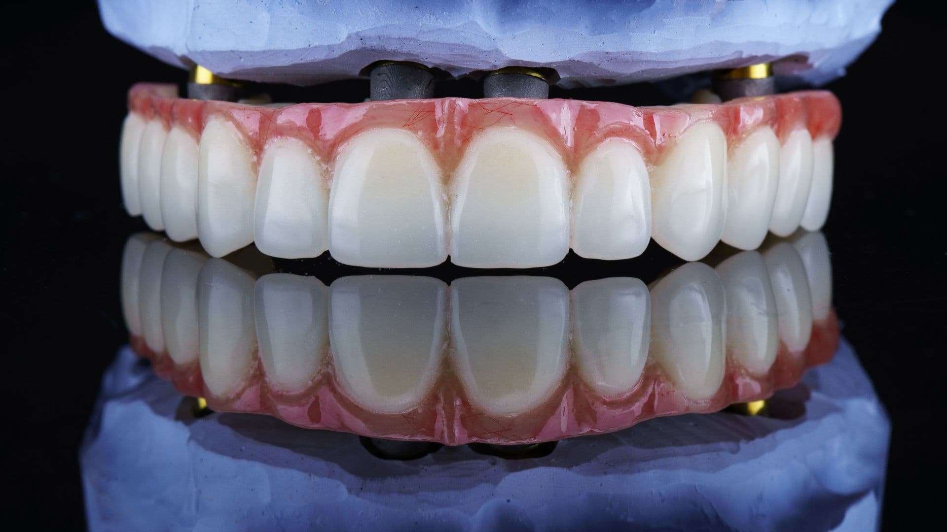 Full Mouth Rehabilitation near Alambadi, Porbandar | Top Rated