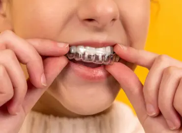 Braces and aligners orthodontic treatment in Rajkot