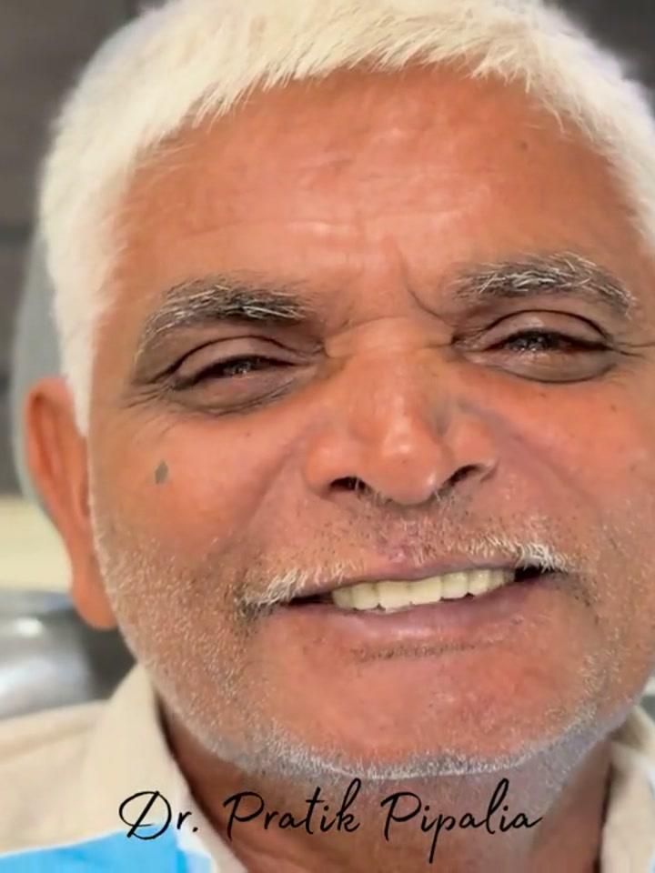 Keshavjibhai S from Kalawad after dental implant at Aarogyam Dental Clinic, Mavdi, Rajkot, Gujarat
