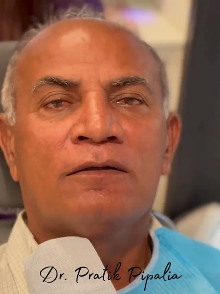 S Rameshbhai from Gondal after dental implant at Aarogyam Dental Clinic, Mavdi, Rajkot, Gujarat