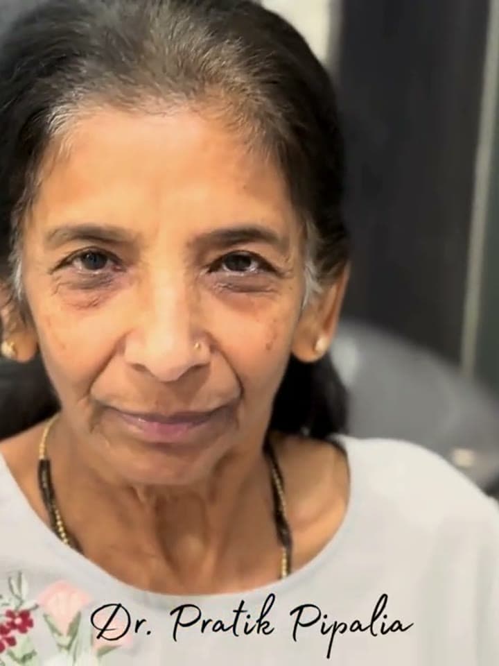 Vijyaben S from UK after dental implant at Aarogyam Dental Clinic Rajkot Gujarat — dental tourism patient