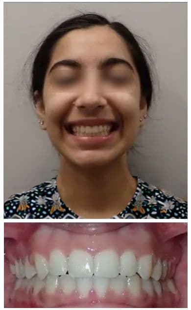 After smile treatment โ facial view