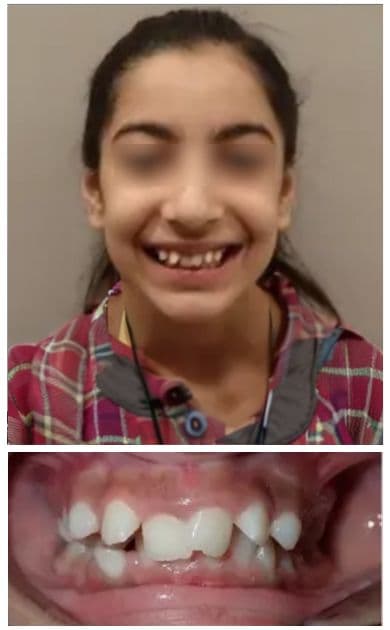 Before smile treatment โ facial view