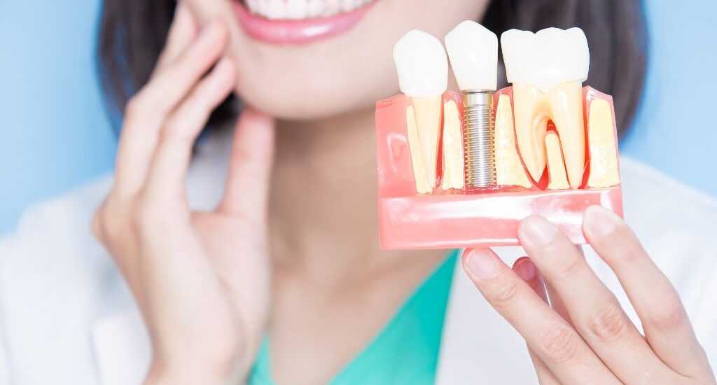 dental implants right for you rajkot gujarat india