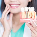 dental implants right for you rajkot gujarat india