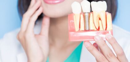 dental implants right for you rajkot gujarat india