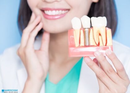 dental implants right for you rajkot gujarat india