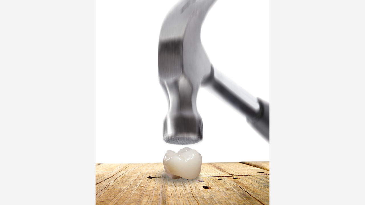 zirconia strong teeth crown rajkot gujarat zirconia strong teeth crown rajkot gujarat